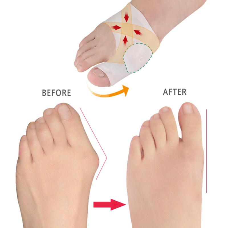 Silicone Gel Foot Fingers Orthotics Big toe overlap toe splitter great toe valgus splitter bone toe Separator Toe protection