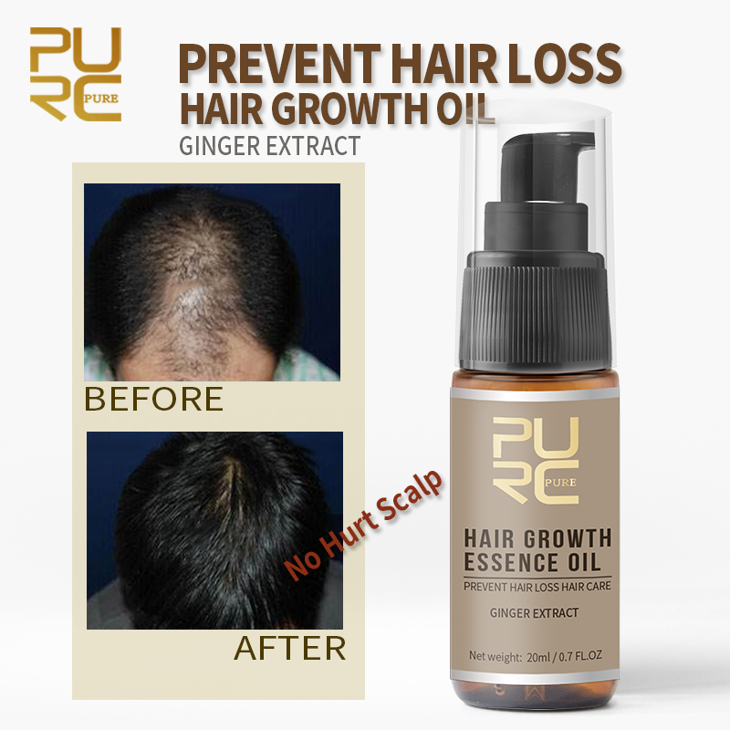PURC Hot sale Fast Hair Growth Oil Hair Loss Treatment Help for hair Growth Hair Care Ginger Extract 20ml TSLM2