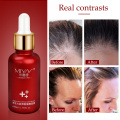 Hair Growth Essence Oil Spray Fast Hair Growth Natural Anti Hair Loss Treatment Hair Solution Hair Care Products Hair Tonic