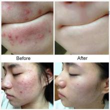 Sea Salt Soap Removal Pimple Pores Acne Treatment Cleaner Moisturizing Wash Care Skin Milk Soap Base Face Goat N5V7