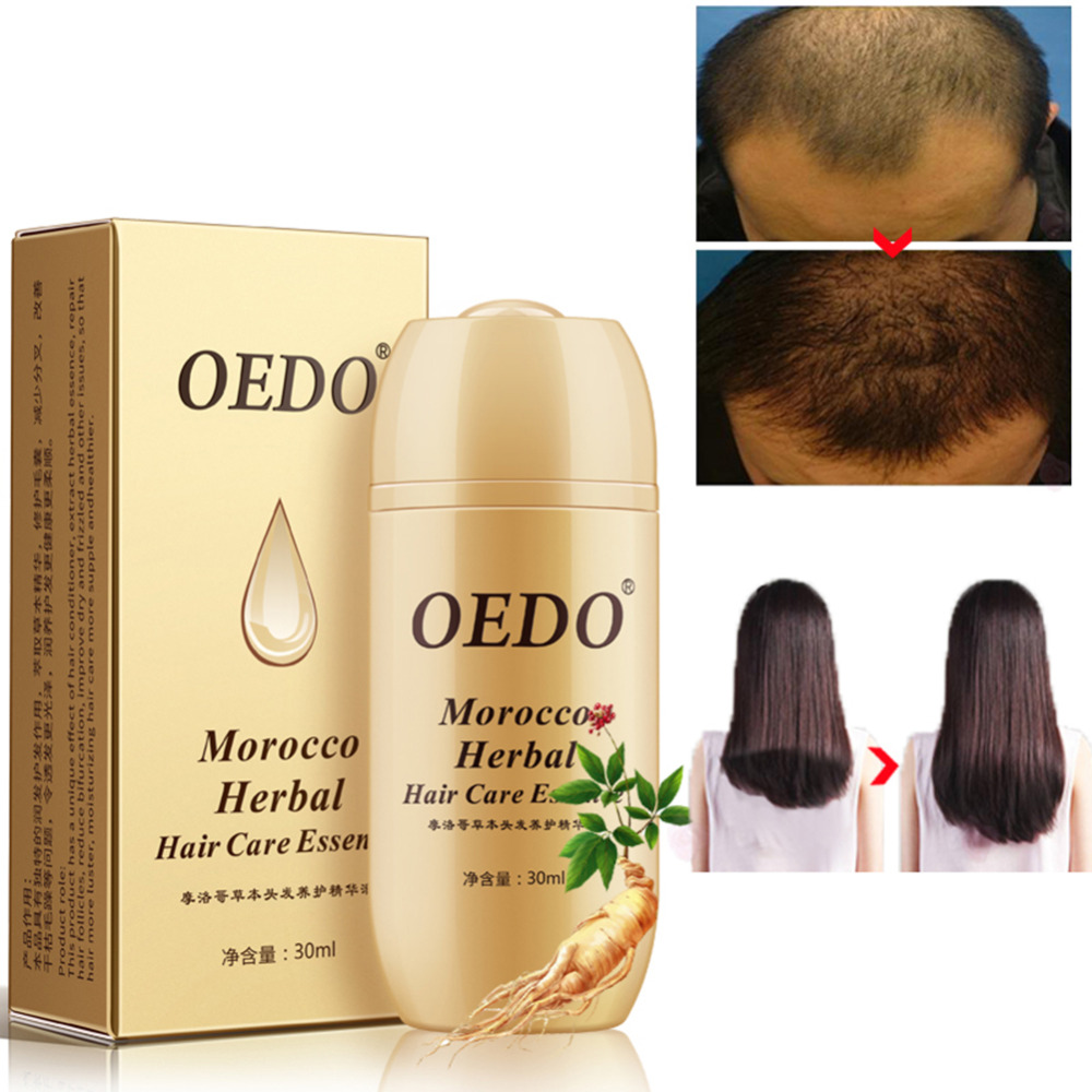 Morocco Hair Growth Essence Oil Preventing Hair Loss Promote Hair Thick Fast Powerful Growth Repair Hair Root 30ml TSLM2
