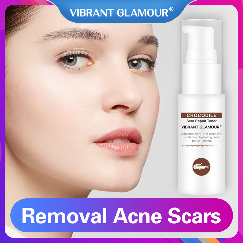 VIBRANT GLAMOUR Crocodile Face Toner Repair Scar Serum Removal Acne Scar Marks Shrink Pores Brighten Relieve Sensitive Skin Care