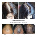 LANBENA Fast Powerful Hair Growth Products Hair Spray Essence Anti Hair Fall Treatment Laser Hair Regrowth For Women And Men