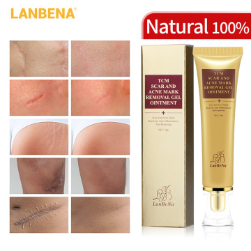 LANBENA Acne Scar Removal Face Cream Acne Spots Acne Pigmentation Corrector Anti Scar Stretch Marks Repair Skin Care 30G