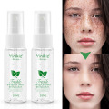 Freckle Inhibition Spray Fade Dark Spot Corrector Facial Skin Whitening Lightening Serum For Reduces Freckles Melasma