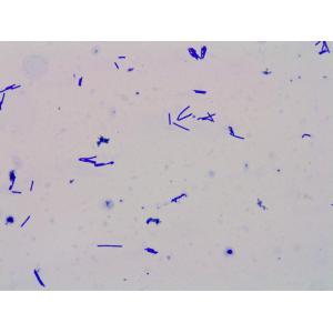 High Potency Freeze Dried Powder Lactobacillus Crispatus