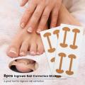 1/5pc Toe sticker Ingrown Toenail Correction stickers Pedicure Tool Toe Inlay Nail Corrector Nail Patch Correction Stickers