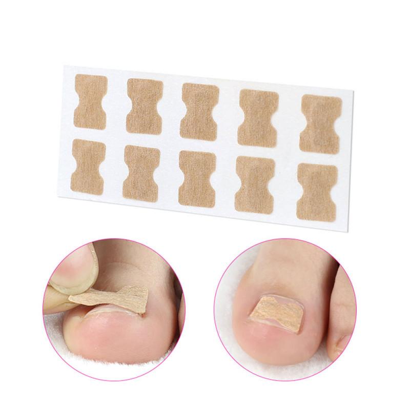 1/5pc Toe sticker Ingrown Toenail Correction stickers Pedicure Tool Toe Inlay Nail Corrector Nail Patch Correction Stickers