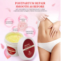 High Quality Smooth Skin Cream For Stretch Marks Scar Removal To Maternity Skin Repair Body Cream Remove Scar Care Postpartum