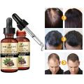 Fast Hair Growth Remedy Essence Oil Oriental Oils Hair Nutrition Hair Loss Treatment Solutions Product Hair Regrowth Product50ml