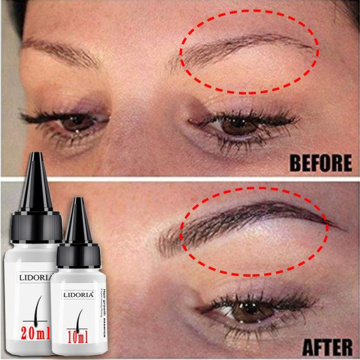 20ml Fast Hair Growth Serum Anti Preventing Hair Lose Liquid Damaged Hair Repair Treatment Eyelash Eyebrow Growing Thick Care