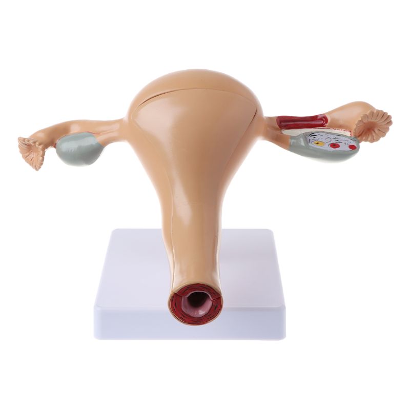 Human Pathological Uterus Ovary Model Anatomical Anatomy Disease Pathology Medical Lesion For Teaching Dropshipping