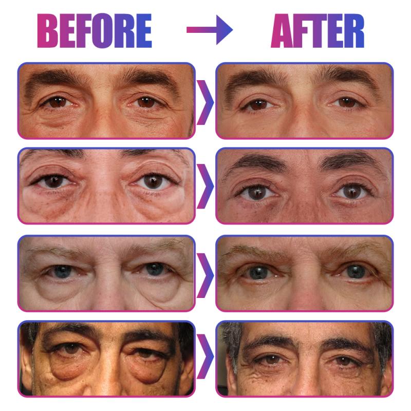 Men's Eye Cream Bioaqua Day And Night Dark Laikou Circles Ojeras Remover Eye Bags Anti Aging Cream Men Skin Care Dropship TSLM1