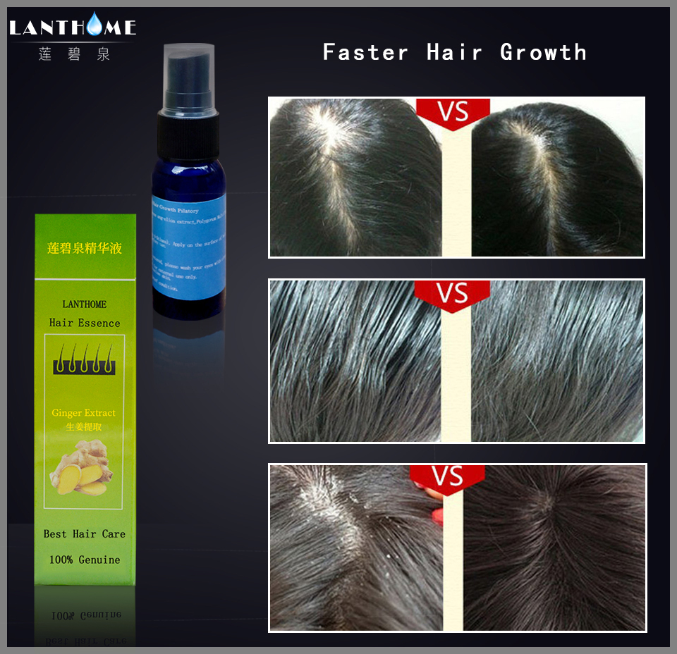 2pcs Herbal Fast Hair Growth Serum Oil Alopecia Anti Baldness Essence Hair Loss Spray Hair Regrowth Treatment Products Men Women