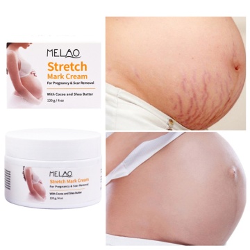 Stretch Mark Reducers Nourishing Skin Remove Stretch Marks Wrinkles Firming Skin Anti-Stretch Mark Cream Nourishing Skin M2