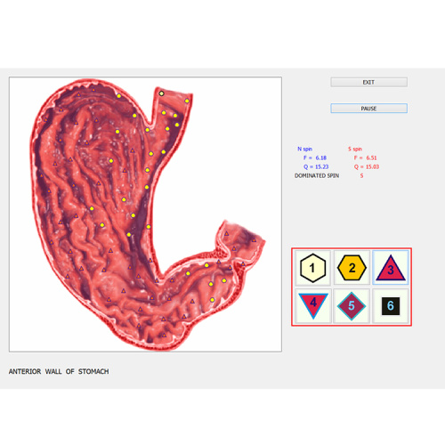 bio quantum health analyzer 9d nls scanner for Sale, bio quantum health analyzer 9d nls scanner wholesale From China