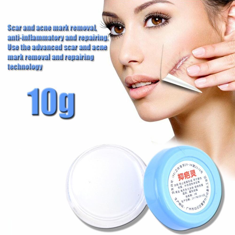 10g Stretch Mark Remover Skin Care Scar Cream From Scar Bio Treatment Cream Oil Body Skin Repair Marks Maternity Care Stret Q6V6