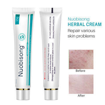 Nuobisong Natural Herbal Topical Cream Face Pimples Scar Stretch Marks Removal Acne Cream Whiten Face Skin Care Treatment TSLM1