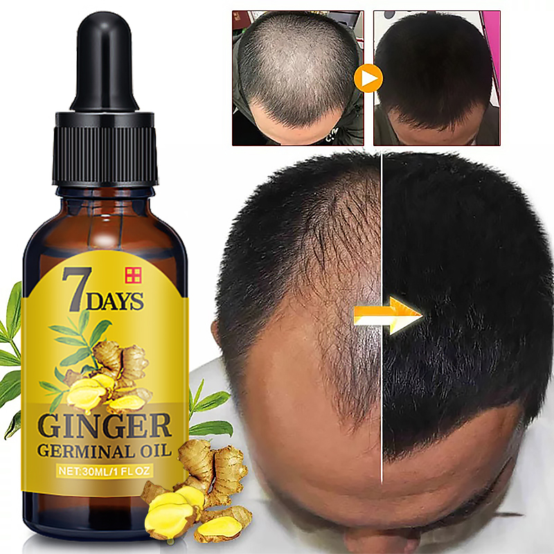 7 Day Ginger Germinal Oil Serum Essence Oil Natural Hair Loss Treatement Effective Fast Growth Hair Care Essence Serum 30g TSLM1