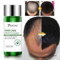 Effective Anti Hair Loss Hair Growth Serum Hair Fast Growing Natural Ginger Oil Hair Care Hair Loss Product