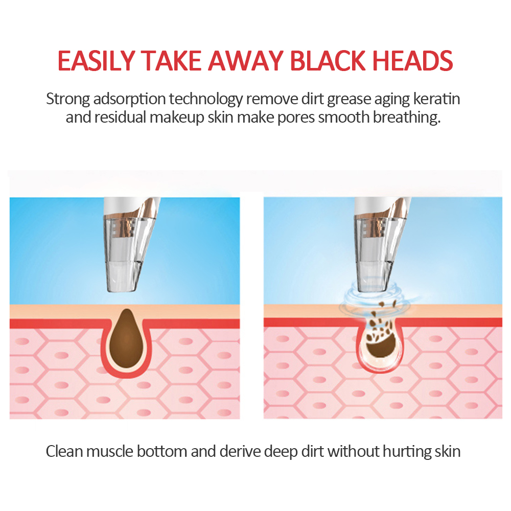 Blackhead Remover Skin Care Pore Vacuum Acne Pimple Removal Vacuum Suction Machine with 3 Probes Face Clean Tools