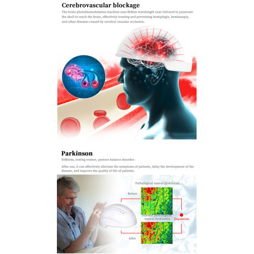 Medical brain modulated cap infrared helmet laser helmet for Sale, Medical brain modulated cap infrared helmet laser helmet wholesale From China