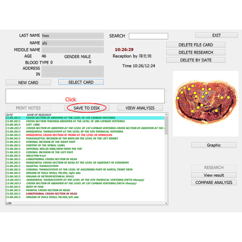 diagnostics Scanner 8d nls 9d nls health analyzer for Sale, diagnostics Scanner 8d nls 9d nls health analyzer wholesale From China