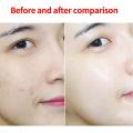 Sea Salt Soap Removal Pimple Pores Acne Treatment Cleaner Moisturizing Wash Care Skin Milk Soap Base Face Goat N5V7