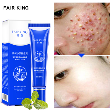 15g Cleansing Acne Cream Moisturize Oil Control Nutrition Whitening Repair Pimple Treatment Cream Facial Skin Care Tools TSLM1