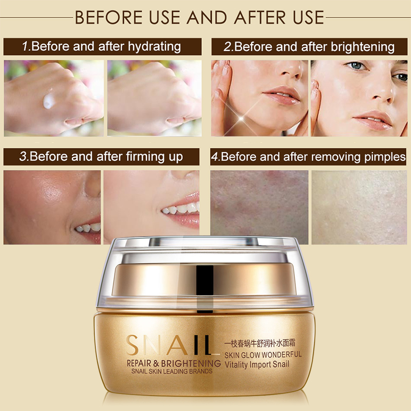 Snail Moisturizing Face Cream Remove Age Spot Scar Pigment Whitening Anti Wrinkle Cream Beauty Miracle Glow Day & Night Cream