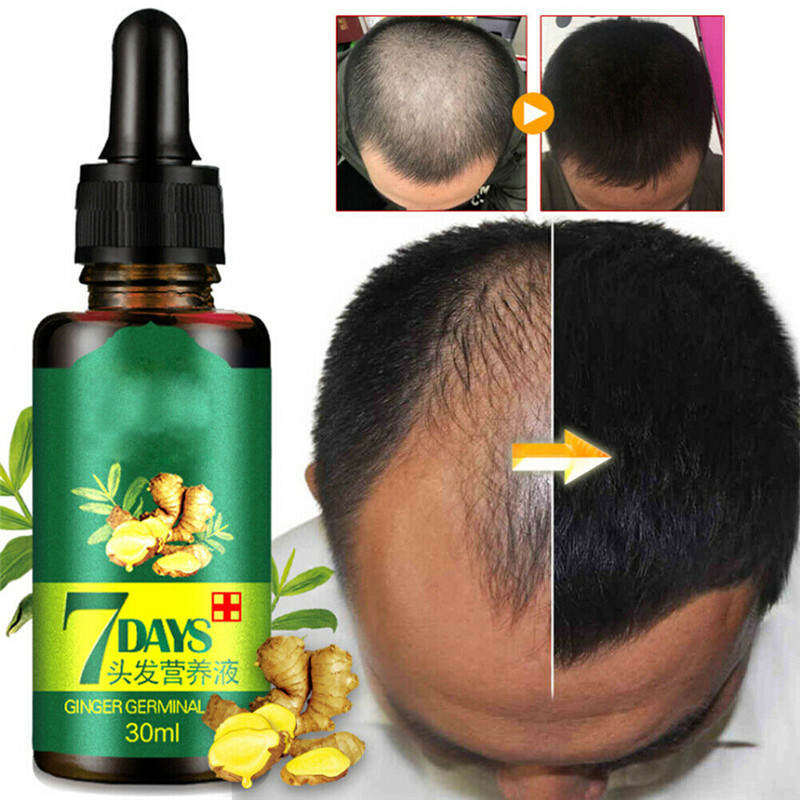 30 ML Effective Fast Growth Hair Serum Essence Oil ReGrow 7Day Ginger Germinal Hair Growth Serum Hairdressing Oil Loss Treatemen