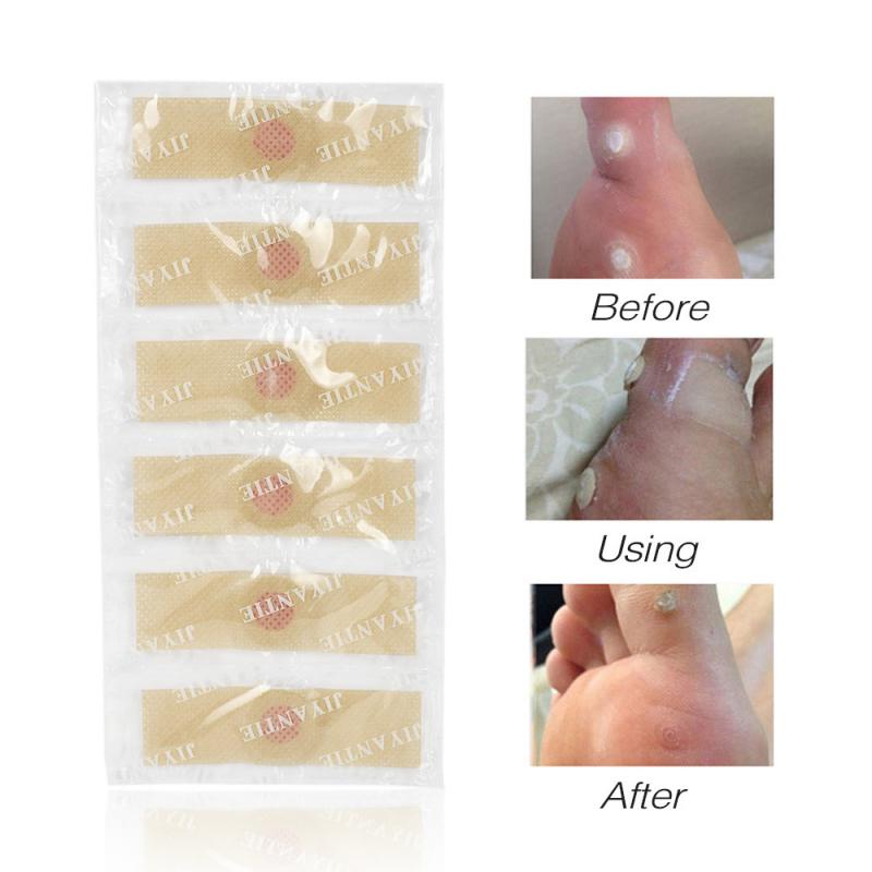 6/12/42PCS Painless Foot Sticker Medical Plaster Foot Corn Removal Patches Warts Thorn Feet Callus Chicken Eye Treatment Sticker