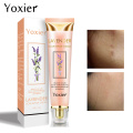 20g Remover Acne Scar Stretch Cream Marks Repair Acne Spots Acne Treatment Face Cream Blackhead Skin Care Whitening Cream