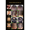 Hair care Hair Growth Liquid Treatment Preventing Hair Loss Natural Protect Dense Hair Serum Drop Shipping TSLM1