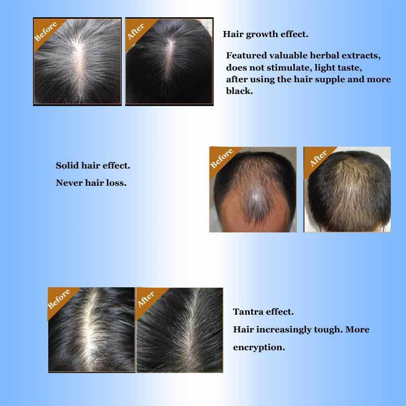 5% Keratin Hair Regrowth Serum Hair Care Deep Repair Damage Hair Root Hair&Scalp Treatment Long Lasting Nourish Mask 30ml TSLM2