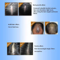 5% Keratin Hair Regrowth Serum Hair Care Deep Repair Damage Hair Root Hair&Scalp Treatment Long Lasting Nourish Mask 30ml TSLM2