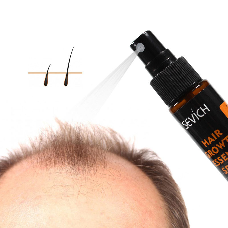 Sevich Hair Growth Spray 30ml Hair Loss Product Hair Regrowth Spray Anti Hair Loss Treatment Thicken Thin Hair TSLM1