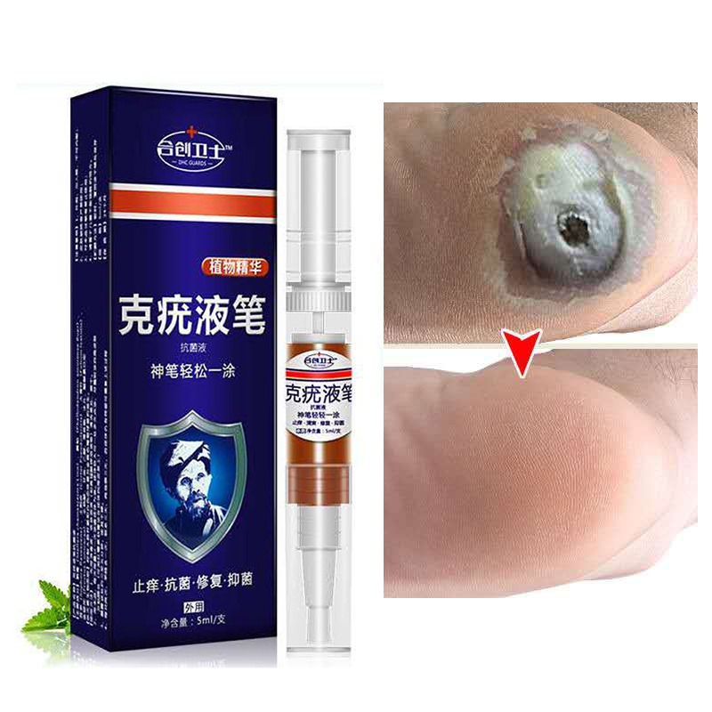 5ML Skin Care Plantar Wart Remover Corn Callus Remover Removal Liquid Pen Stops Regrowth