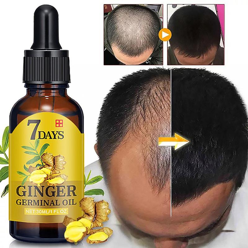 30ml 7 Day Ginger Germinal Oil Serum Essence Oil Natural Loss Essence Growth Hair Serum Effective Care Fast Treatement Hair J9K5