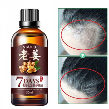 Fast Hair Growth Dense Regrowth Ginger Serum Oil Anti Loss Treatment Essence Hair Care