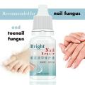 10ml Anti-fungal Cuticle Oil Nail Repair Treatment Toenail Strengthen Mint Brighten Oil Nai Growth Nail Fungi Fungus Manicu M0G1