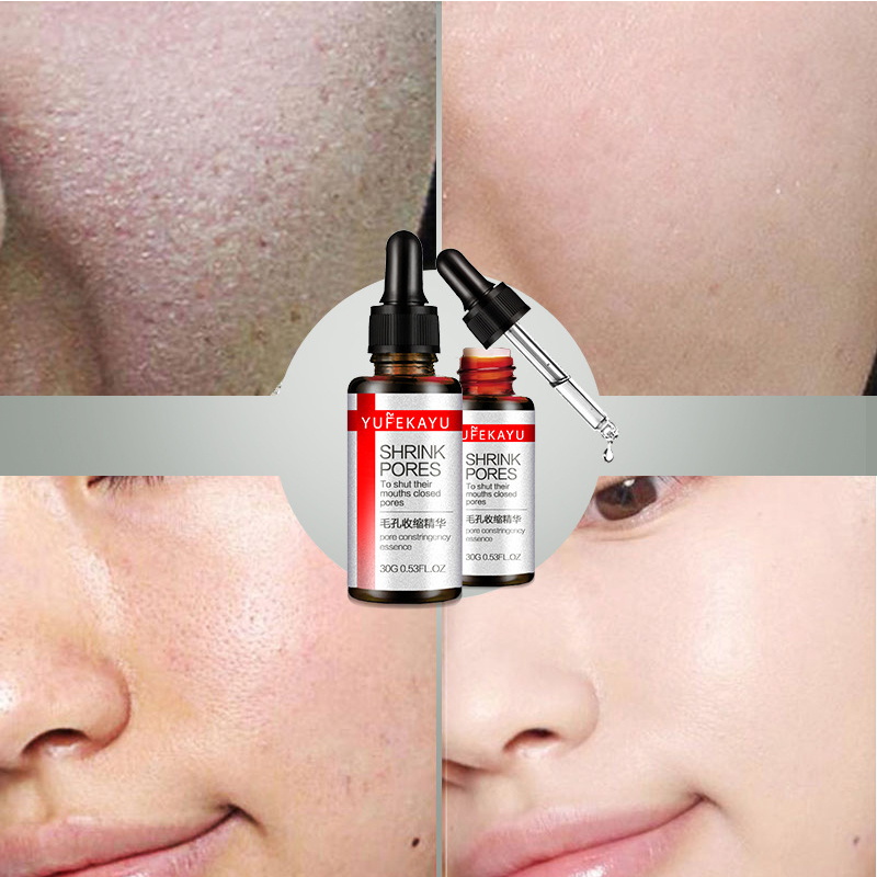 Shrink Pores Face Serum Acne Treatment Essence Blackhead Remover Oil-control Whitening Serum Moisturizing lighten Skin Care