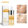LANBENA Vitamin C Serum Essence Mask Remove Dark Spot Freckle Speckle Fade Ageless Whitening Skin Care Whitening Anti Winkles @