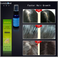 Dropship Fast Hair Growth Spray Products Dense Herbal Hair Regrowth Essence anti Hair Loss Treatment for Men and Women