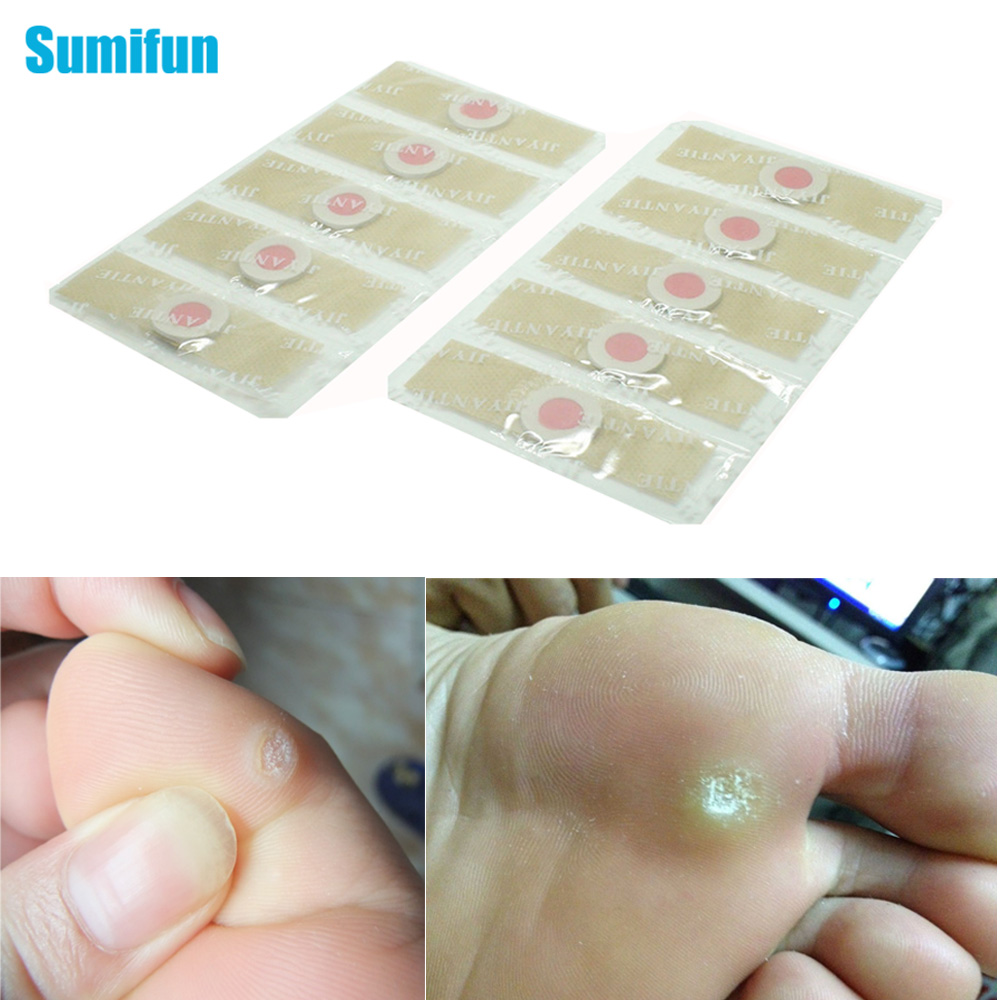 Sumifun 12/36pcs Foot Corn Removal Pain Relief Patch Calluses Plantar Warts Thorn Chinese Natural Herbal Medical Plaster