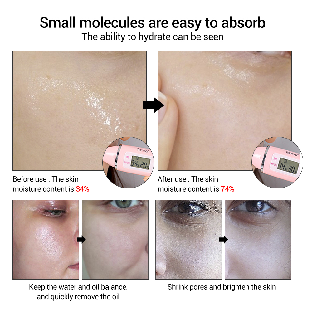 VIBRANT GLAMOUR 2Pcs Hyaluronic Acid Face Serum Shrink Pores Moisturizing Whitening Essence Acne Dry Rough Men Women Skin Care