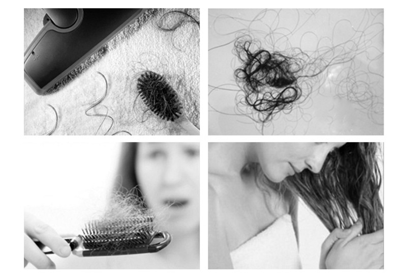 Dimollaure Hair Growth anti Hair Loss Liquid 10ml dense hair fast sunburst hair growth grow alopecia Treatment