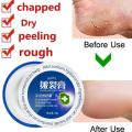 Traditional Chinese Cosmetics Anti Dry Crack Repair Heel Feet Care Foot Balm Exfoliating Foot Creams Hand Cracked Heel Cream