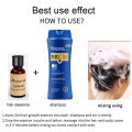 Hair Loss Treatment Oil Control Shampoo for Hair Growth Essence Anti Hair Loss Shampoo Hair Care Products Thickner Hair Serum