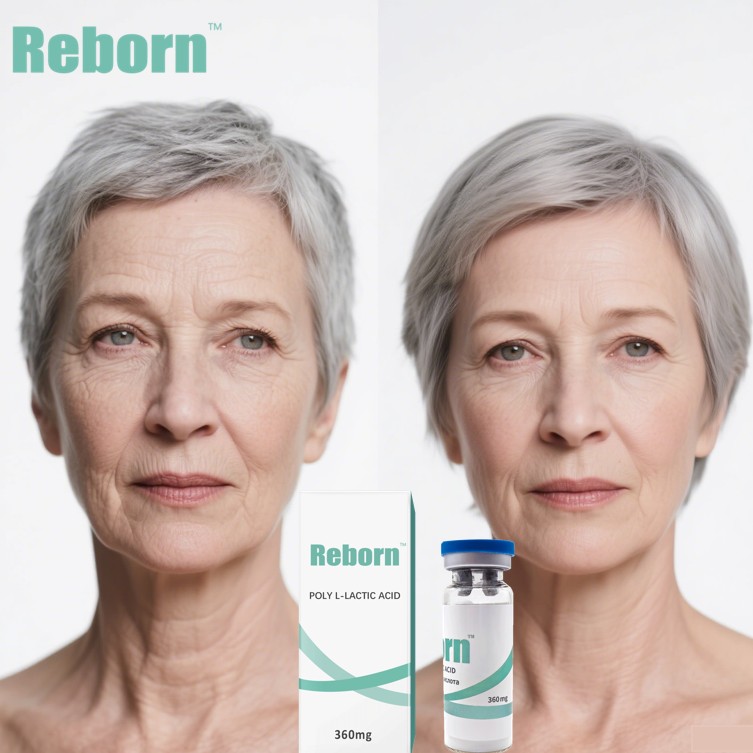 anti-aging filler